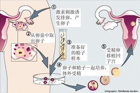 锦书生殖